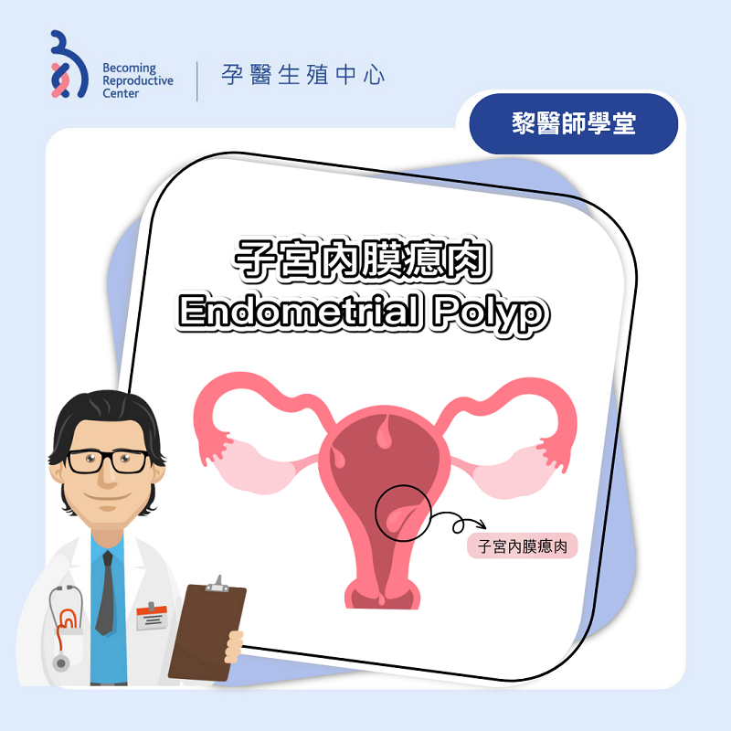 What Are Endometrial Polyps?
