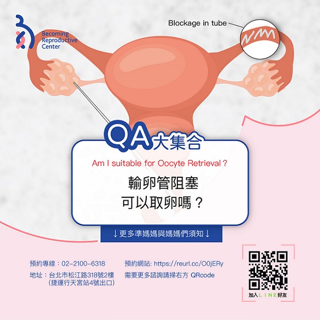 輸卵管阻塞可以取卵嗎?
