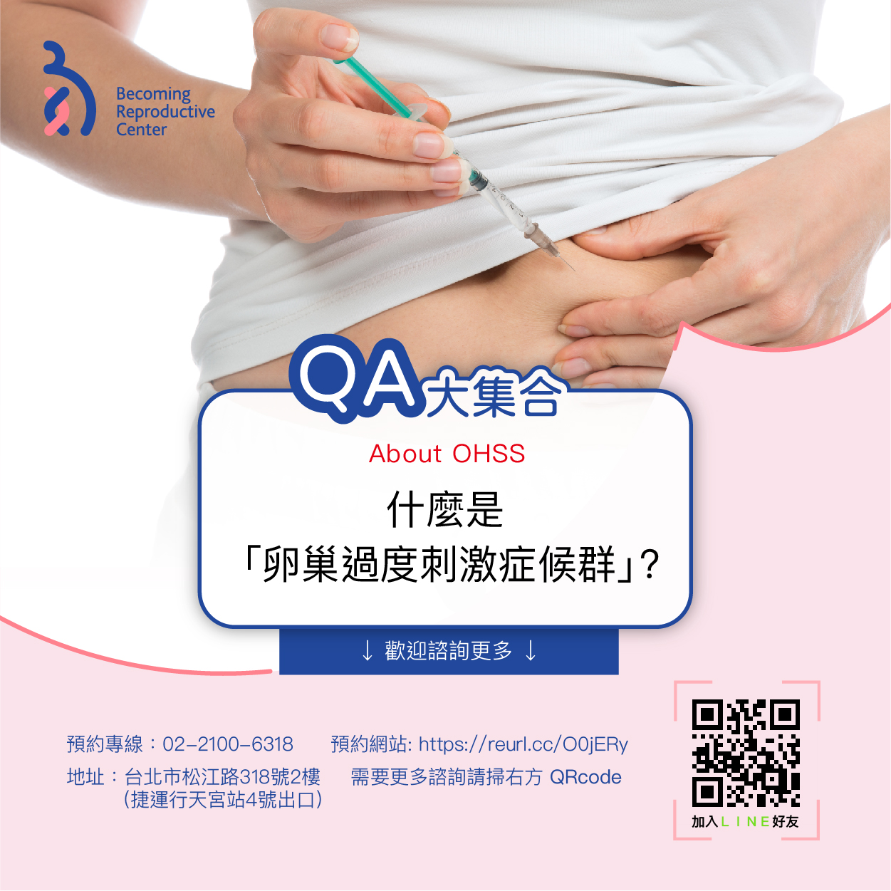 甚麼是卵巢過度刺激症候群?