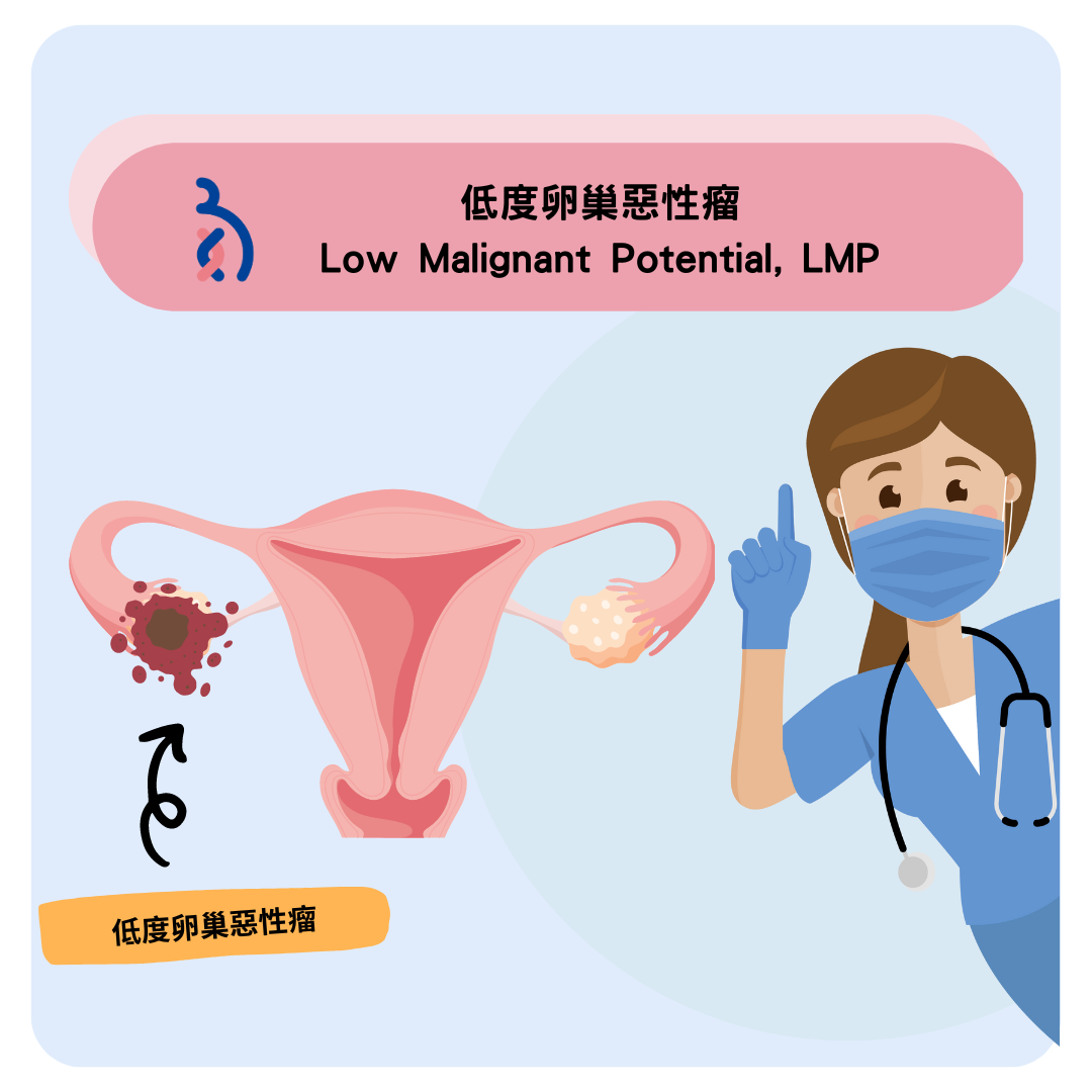 何謂低度卵巢惡性瘤(Low Malignant Potential, LMP)