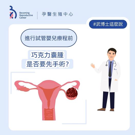 巧克力囊腫手術前須知