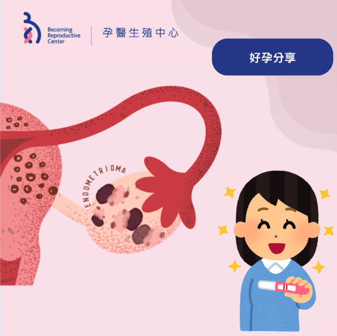 患有腺肌症還有機會懷孕嗎?