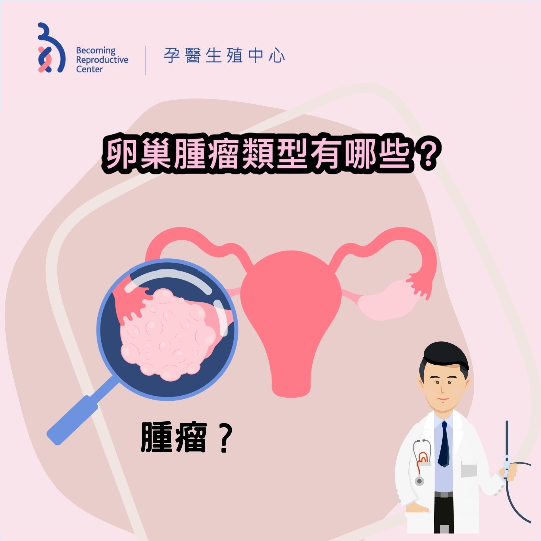婦科常見的卵巢囊腫或卵巢腫瘤