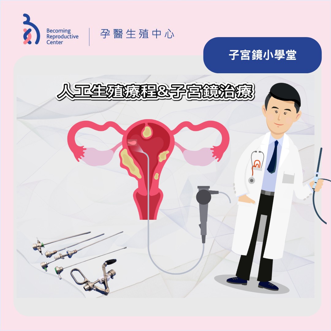 子宮鏡於不孕症之應用