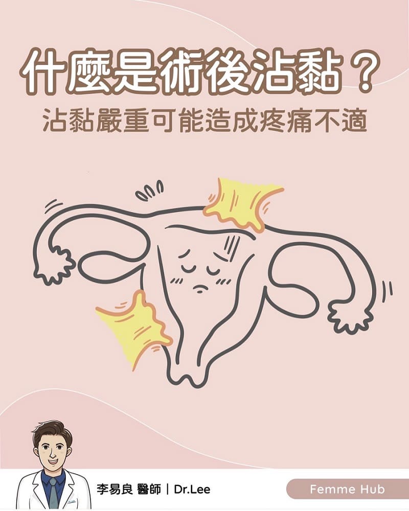 👨🏻⚕️為什麼會有手術後沾黏發生⁉️