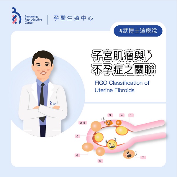 子宮肌瘤與不孕症之關聯