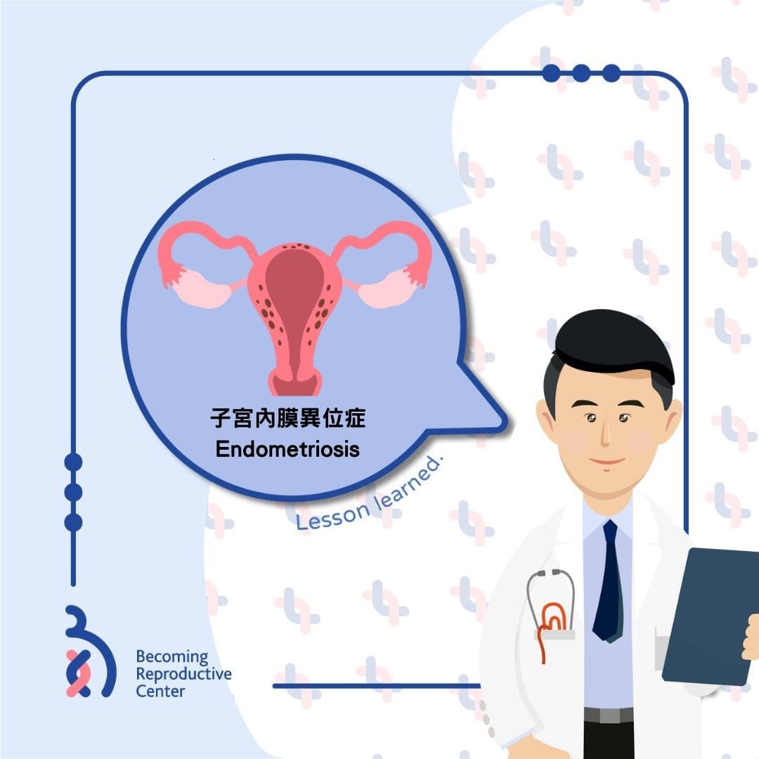 何謂子宮內膜異位症