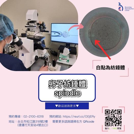 Spindle Observation System: An In-Depth Look at Eggs