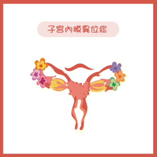 子宮內膜異位症 Endometriosis