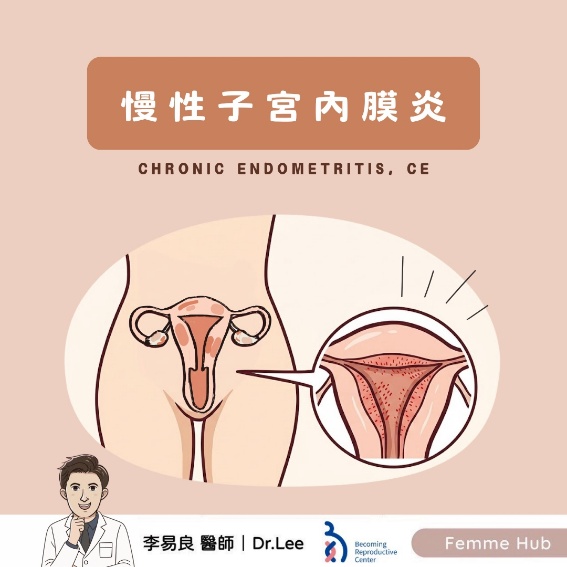 慢性子宮内膜炎が妊娠の妨げにならないために