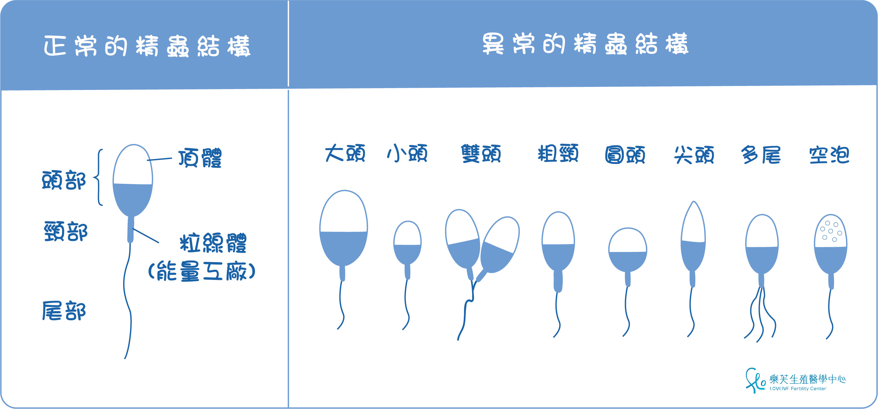 精蟲型態比較